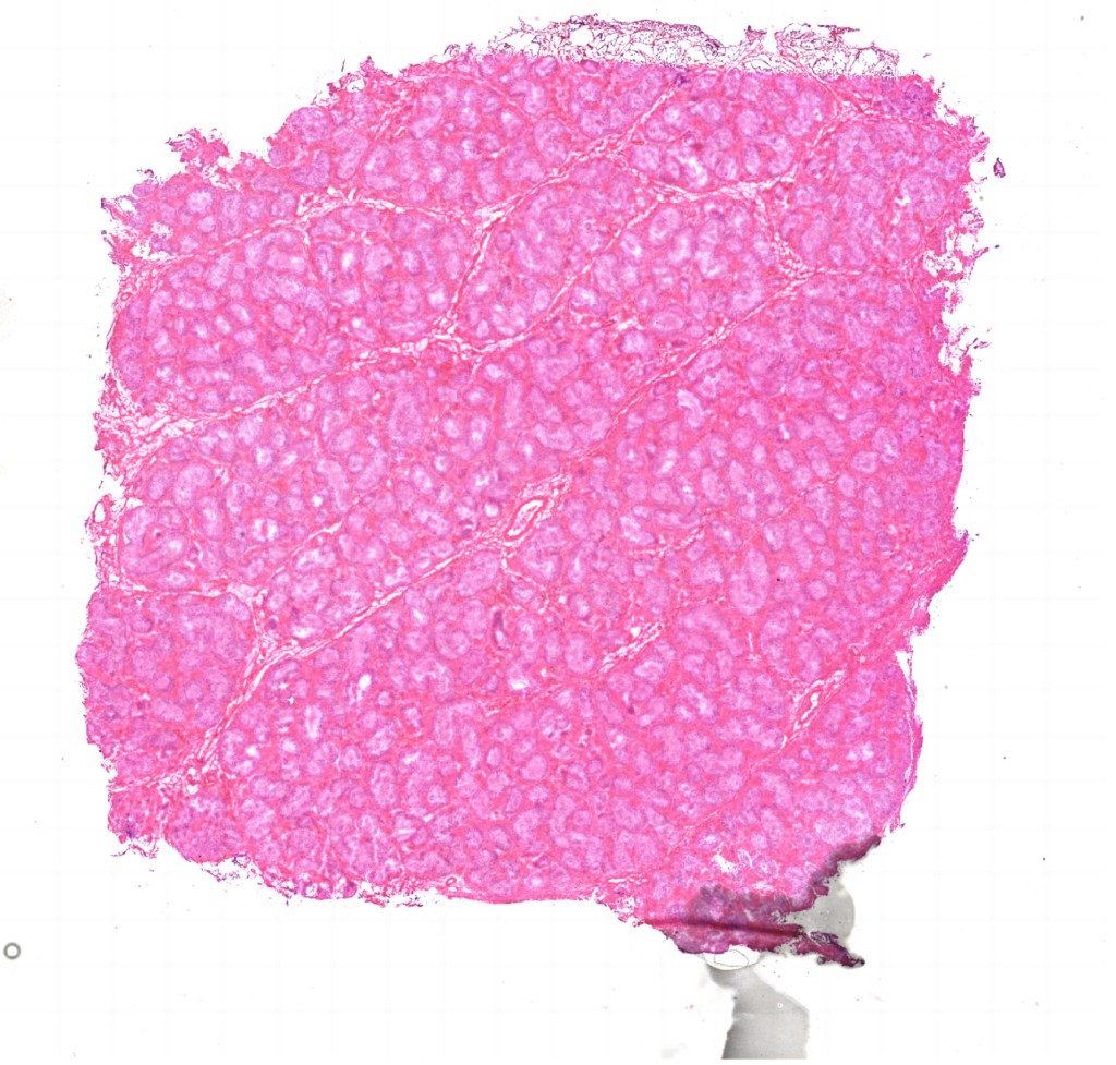 H&E 24m
