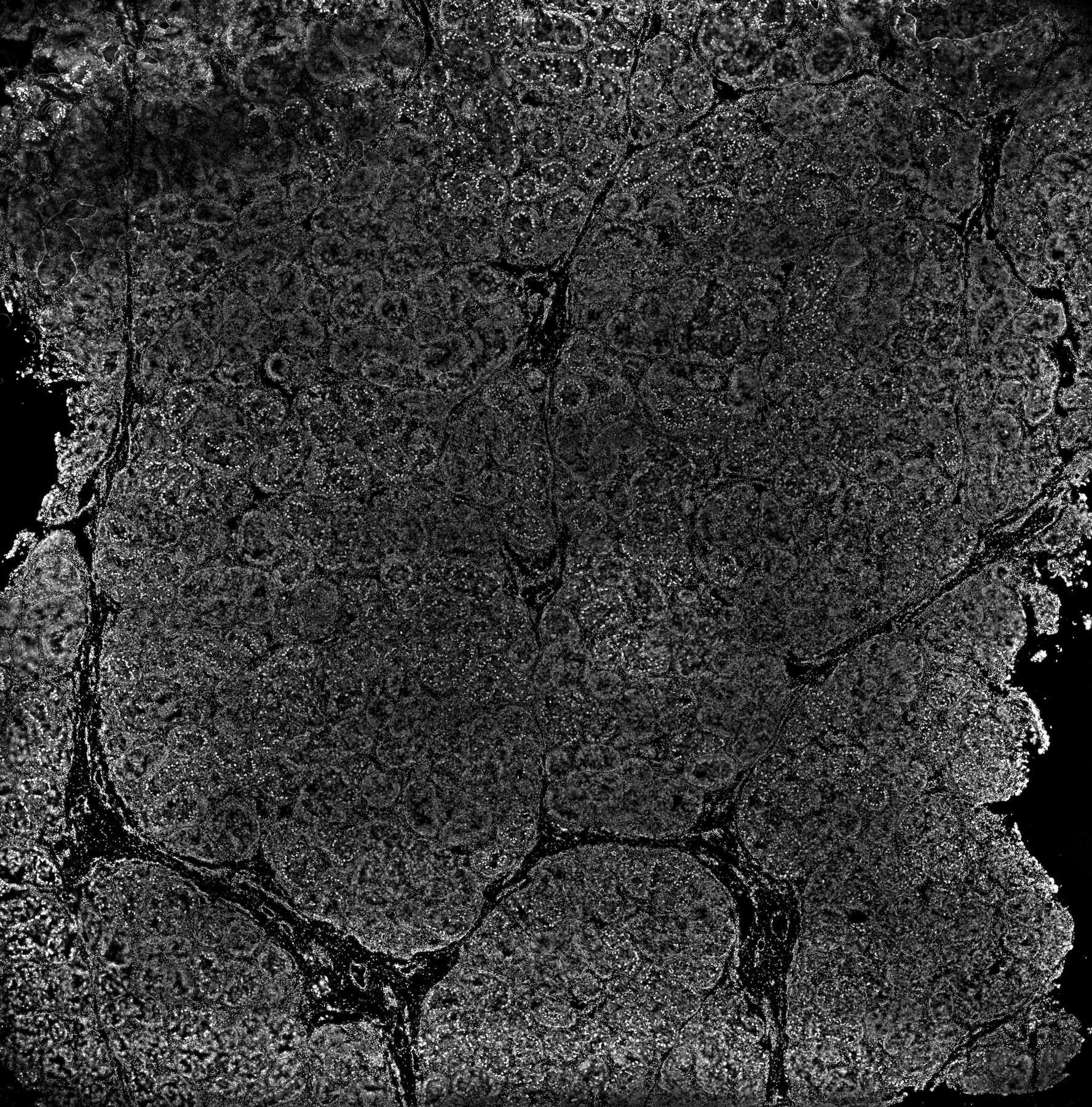 ssDNA 35m