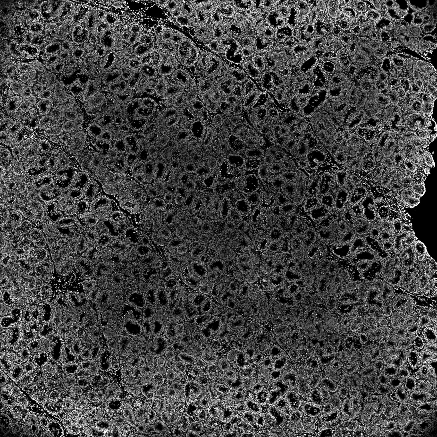 ssDNA 160d