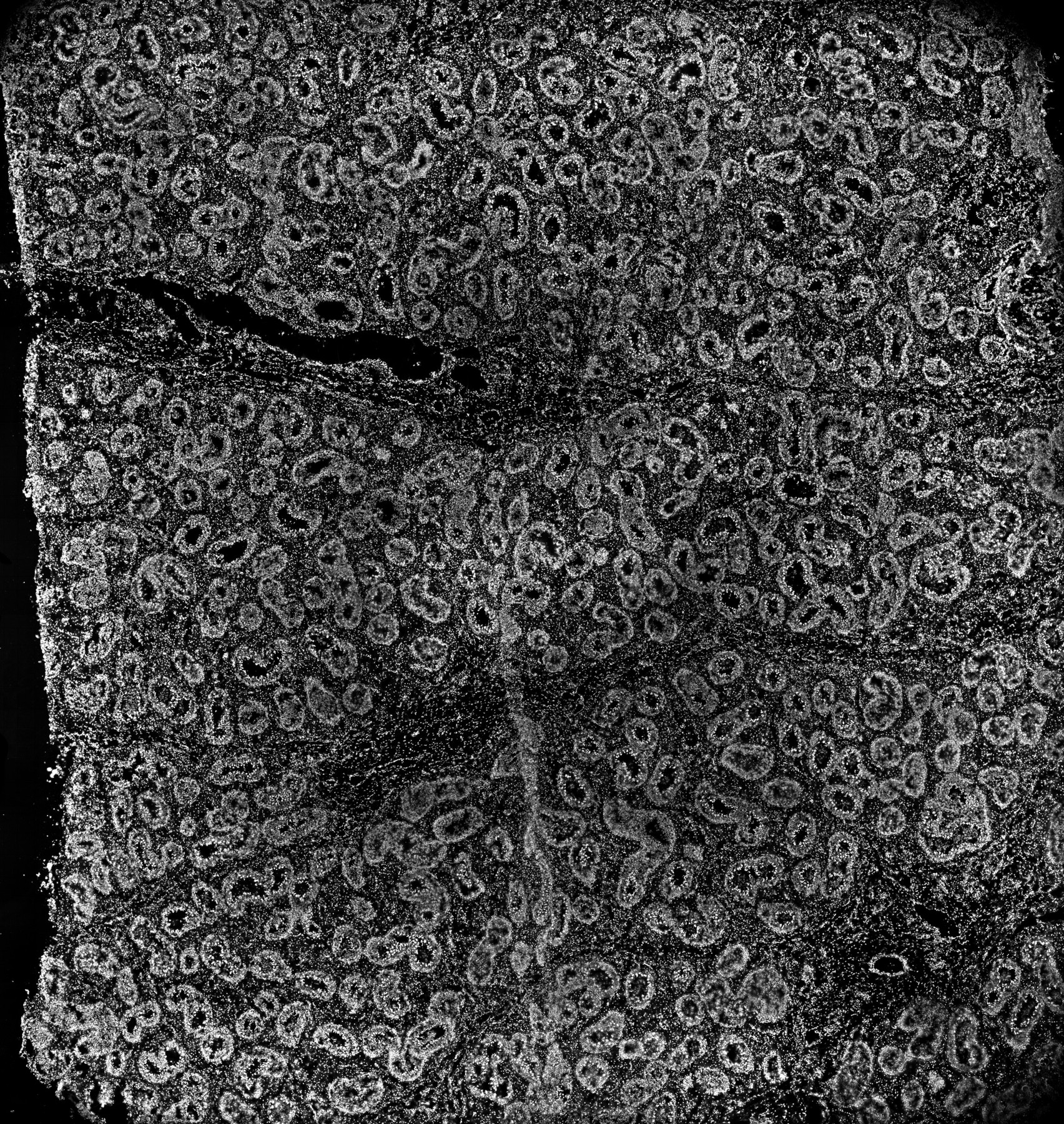 ssDNA 10m