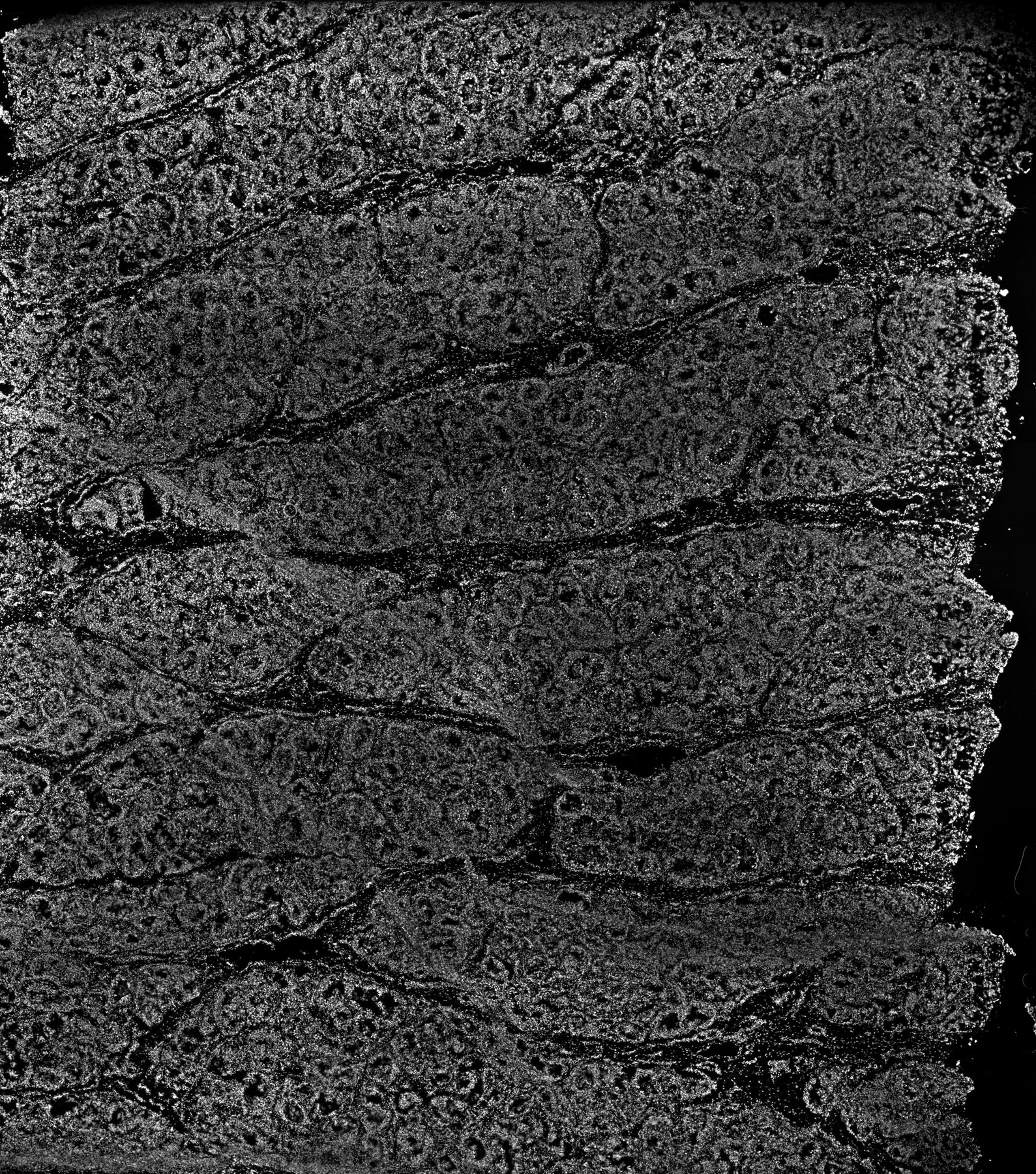 ssDNA ERC