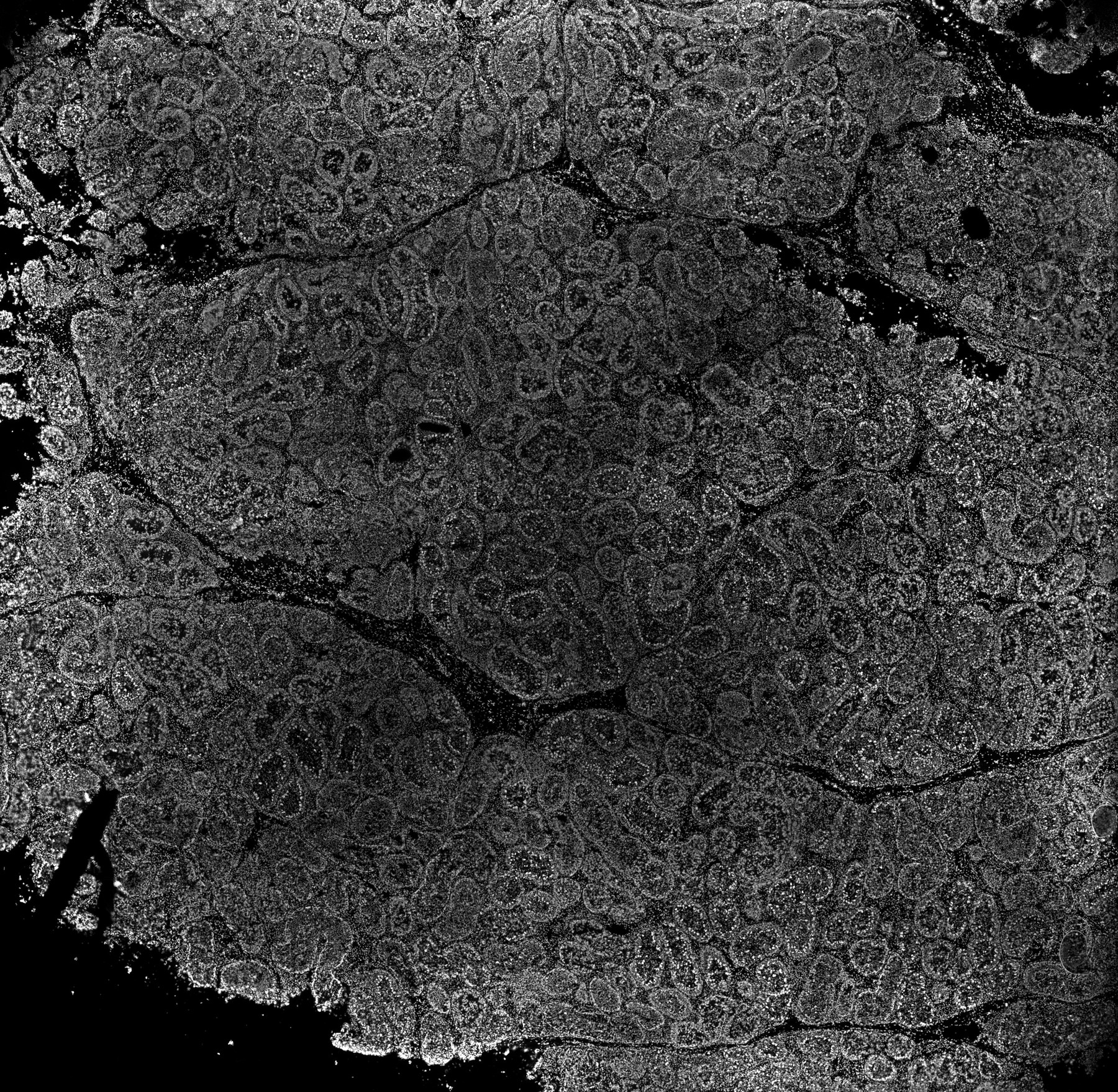 ssDNA 50m
